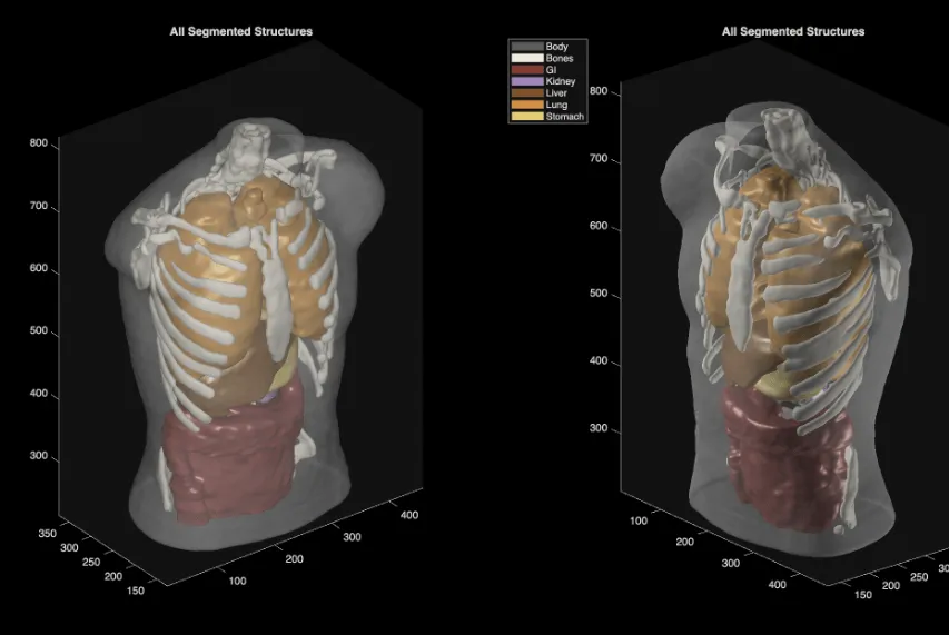 Midjourney Medical: полнотелесный УЗИ-сканер Midjourney Scanner